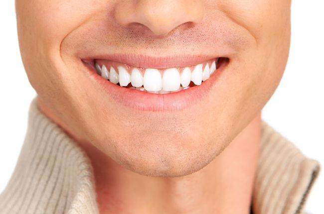 Veneers Veneers